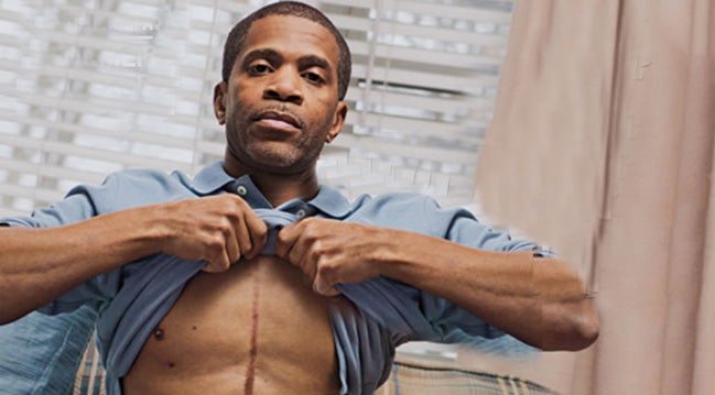 Man shows his scar from tobacco treatment