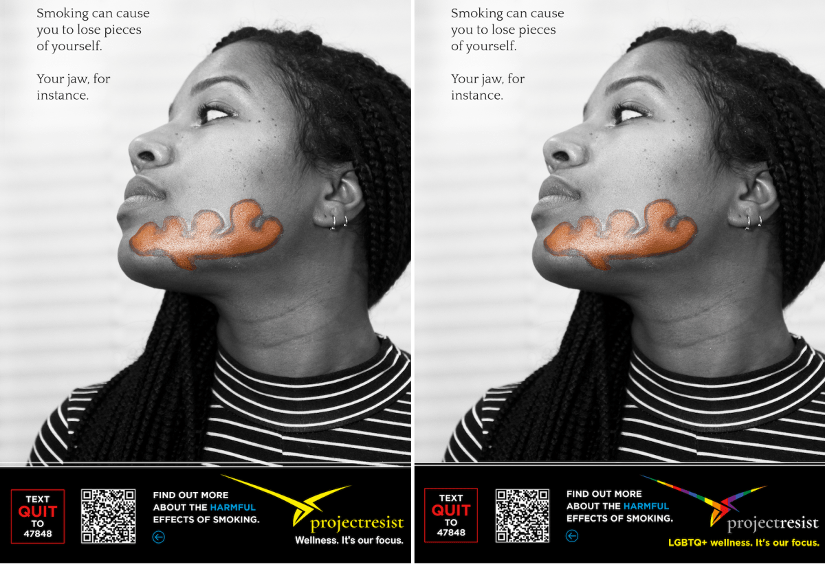 Two anti-smoking ads showing a woman with a highlighted red jaw. They both read, ""Smoking can cause you to lose pieces of yourself. Your jaw, for instance."