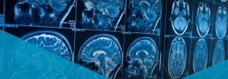 Image of medical brain scans displayed on a screen, photo credit iStock / Movus