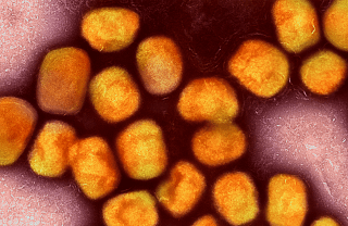 Colorized transmission electron micrograph of monkeypox virus particles (gold) cultivated and purified from cell culture.