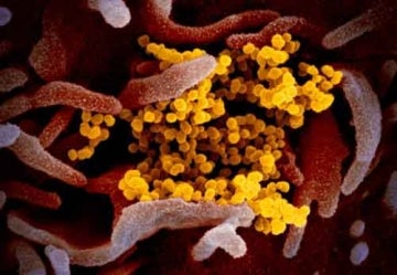 A scanning electron microscope image shows SARS-CoV-2 (yellow)—the virus that causes COVID-19—isolated from a patient in the U.S., emerging from the surface of cells (pink) cultured in the lab